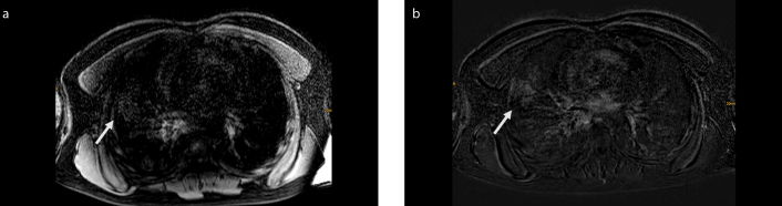 Figure 2. a, b