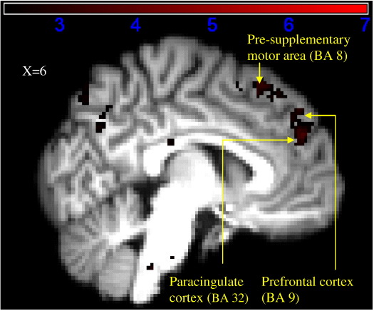 Fig. 3