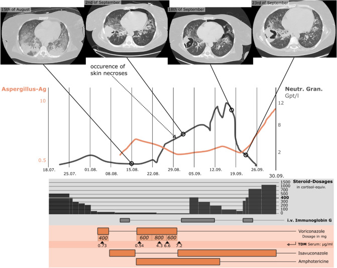 Fig.1