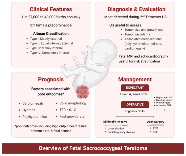 Fetal Teratomas: Advances in Diagnosis and Management - PMC