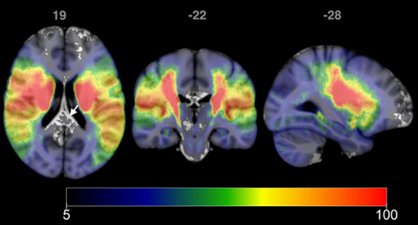 Figure 4: