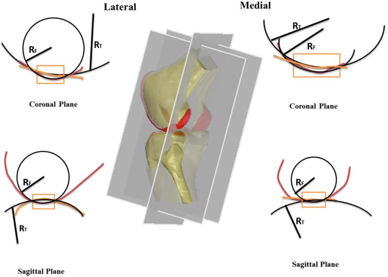 Fig.2