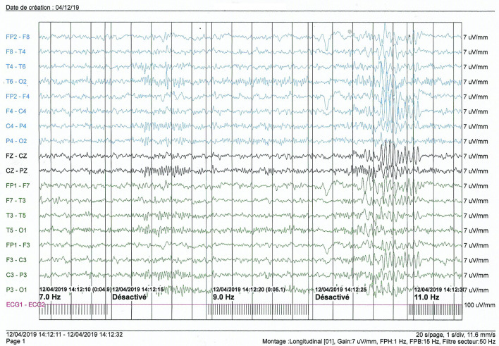 Fig 3