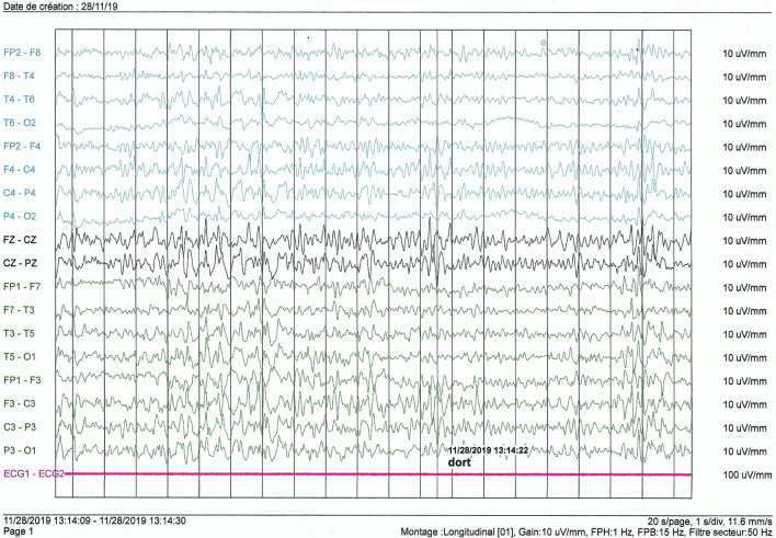 Fig 2