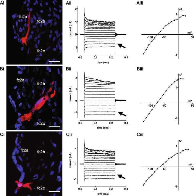 FIG. 4