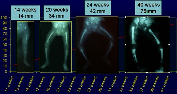 Fig. 1