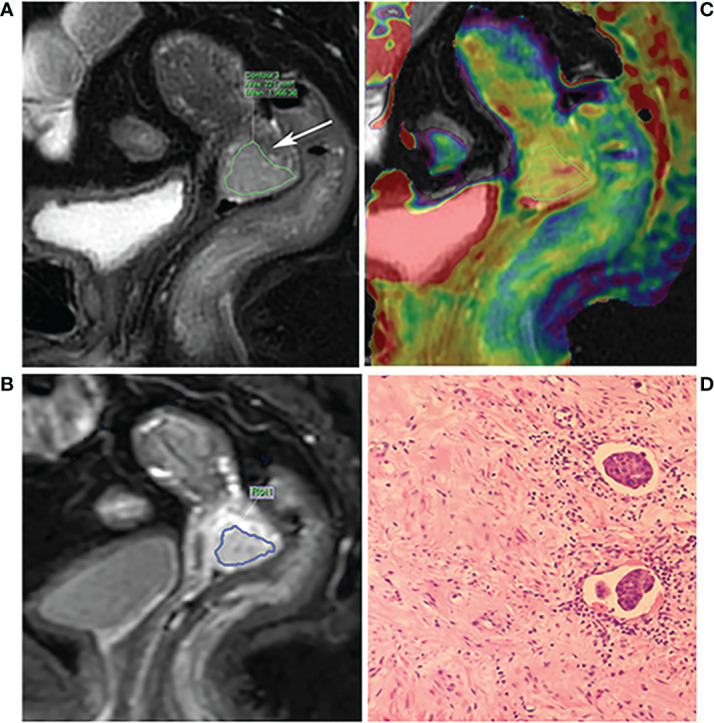 Figure 2