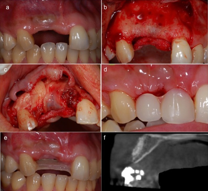 Figure 2