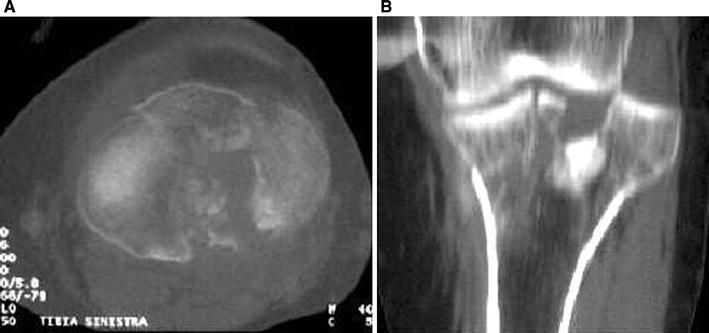 Fig. 17