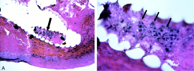 fig 5.