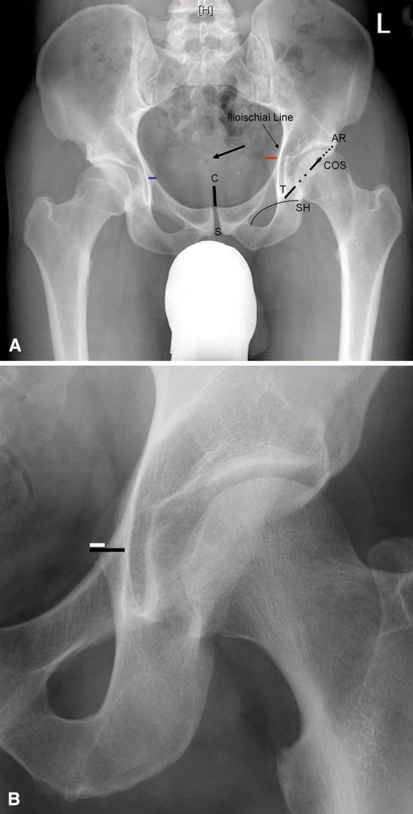 Fig. 2A–B