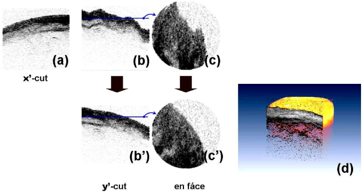 Fig. 11