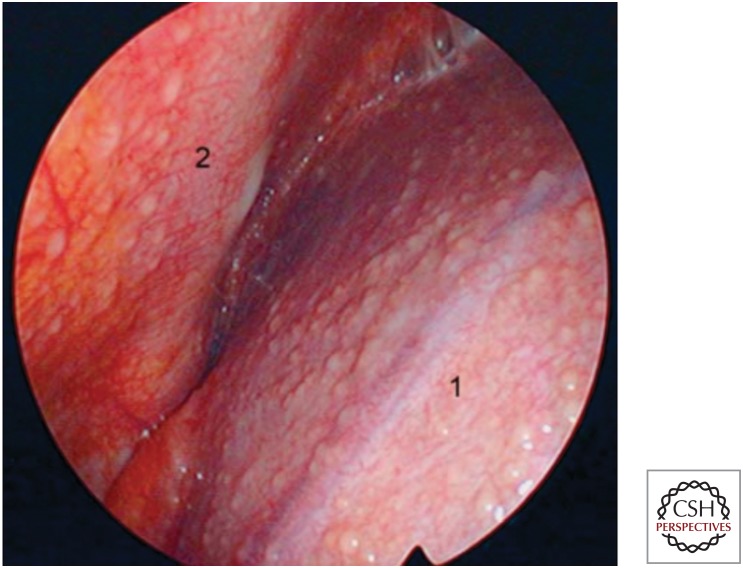 Figure 12.