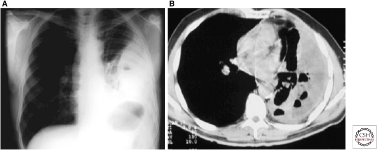 Figure 15.