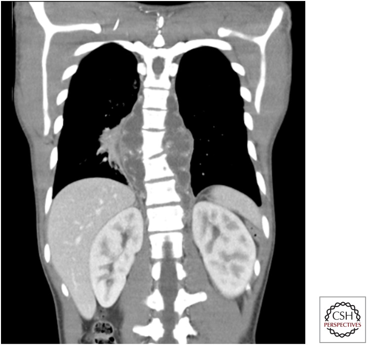 Figure 16.