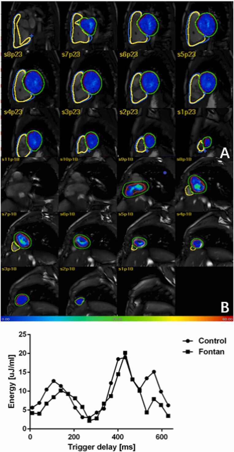 Fig. 4