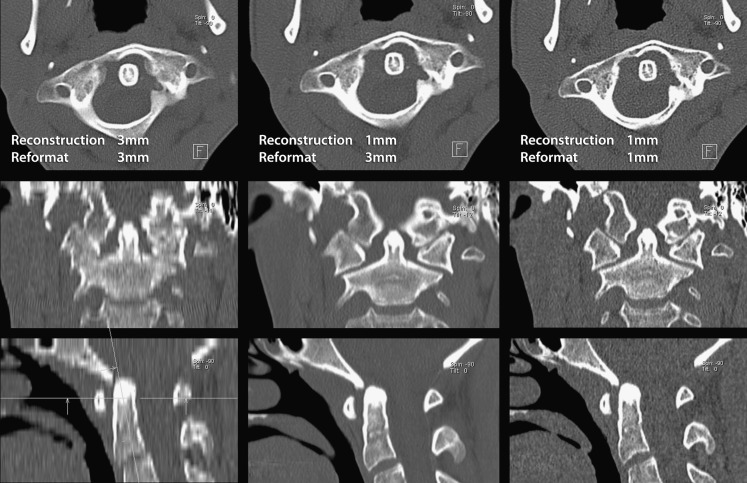 Fig. 3