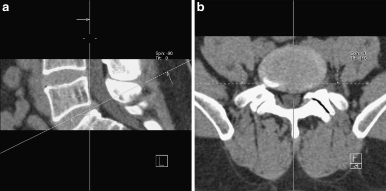 Fig. 10