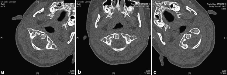 Fig. 2