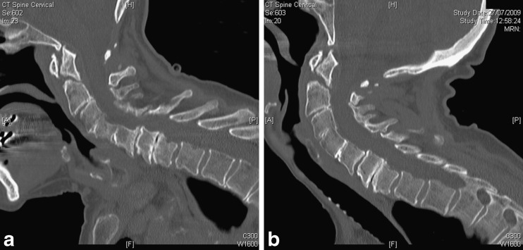 Fig. 1