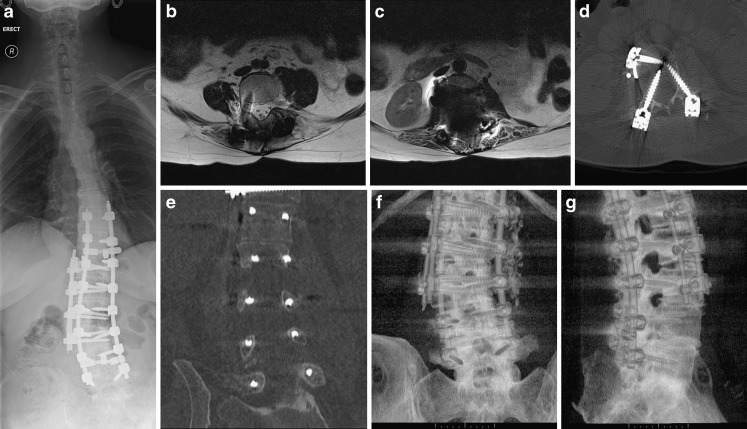 Fig. 11