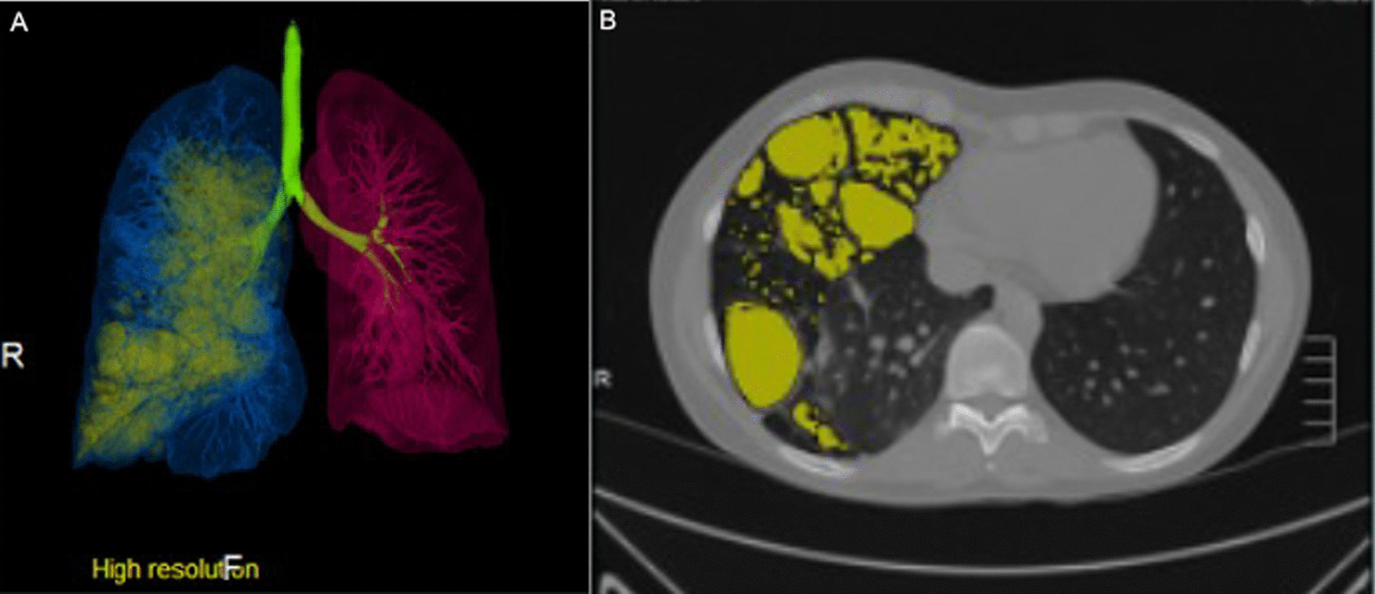 Fig. 2