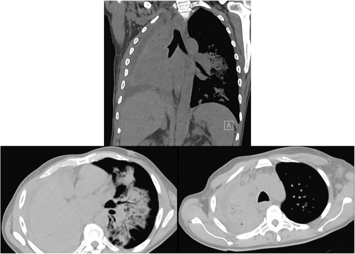 Figure 2