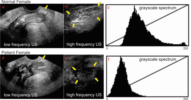 Figure 3: