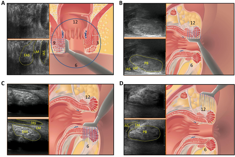 Figure 1: