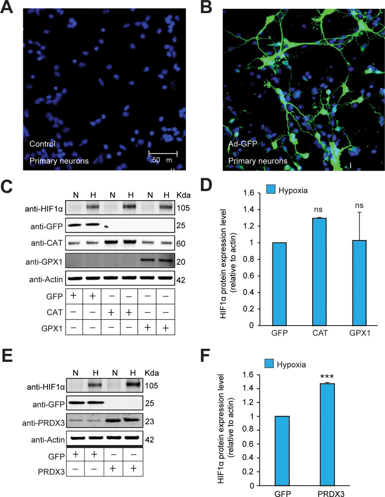 Figure 3—figure supplement 4.