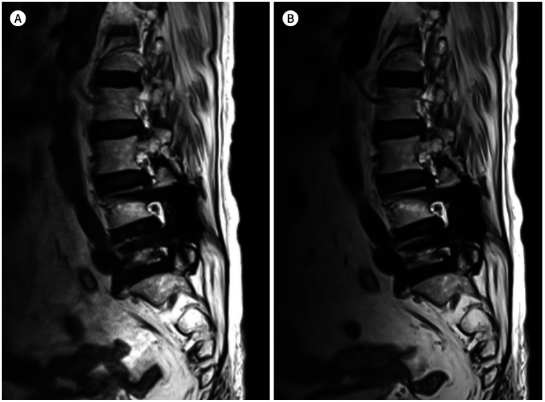 Fig. 12