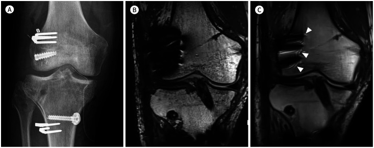 Fig. 9