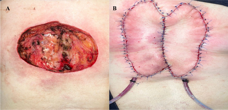 Fig. 3