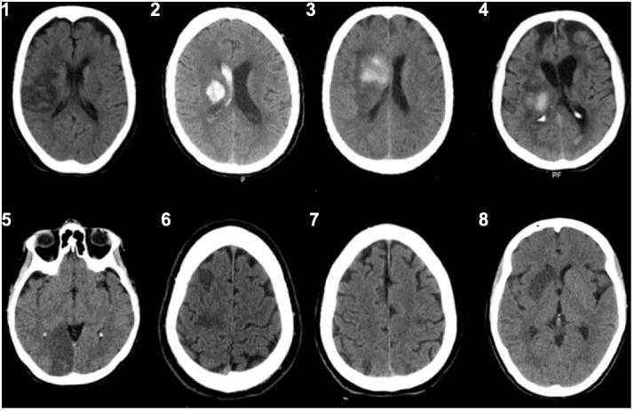 FIGURE 2