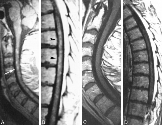 fig 2.