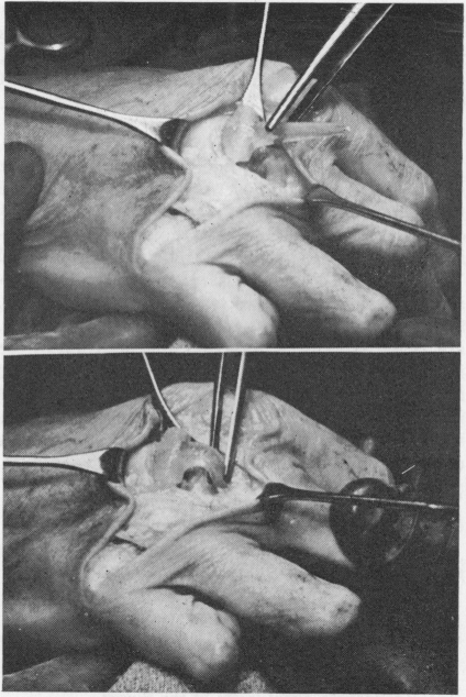 Fig. 44 (a) and (b)