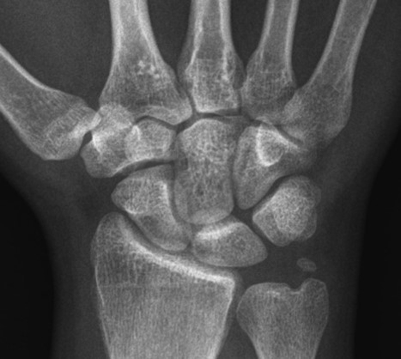Fig. 5