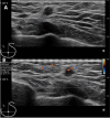 Fig. 6
