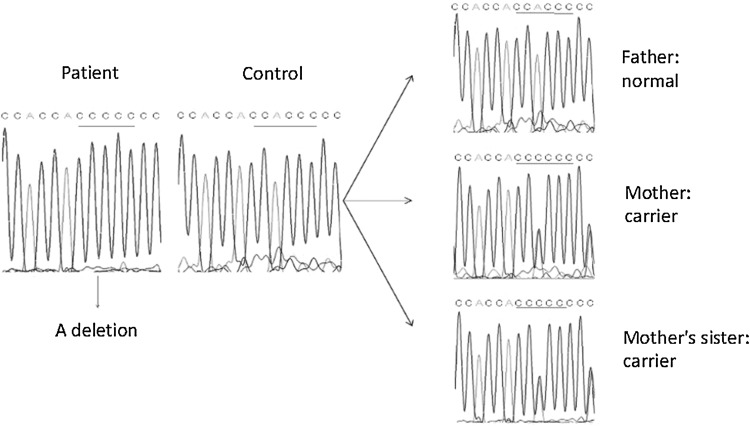 Fig. 1