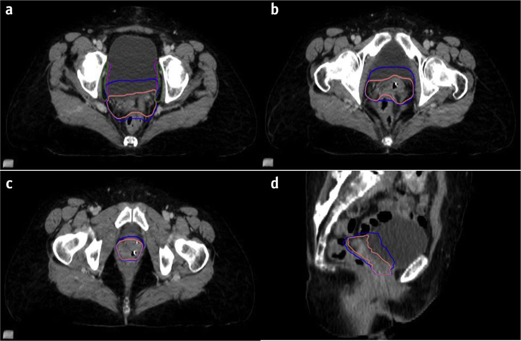 Fig. 5.