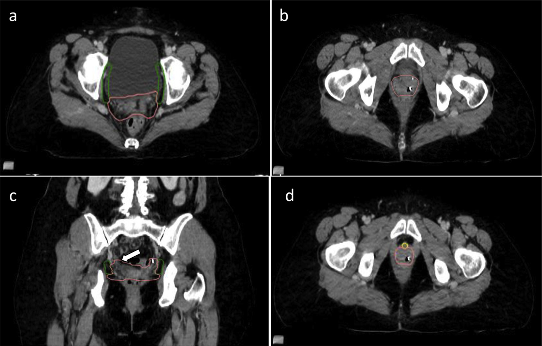 Fig. 6.