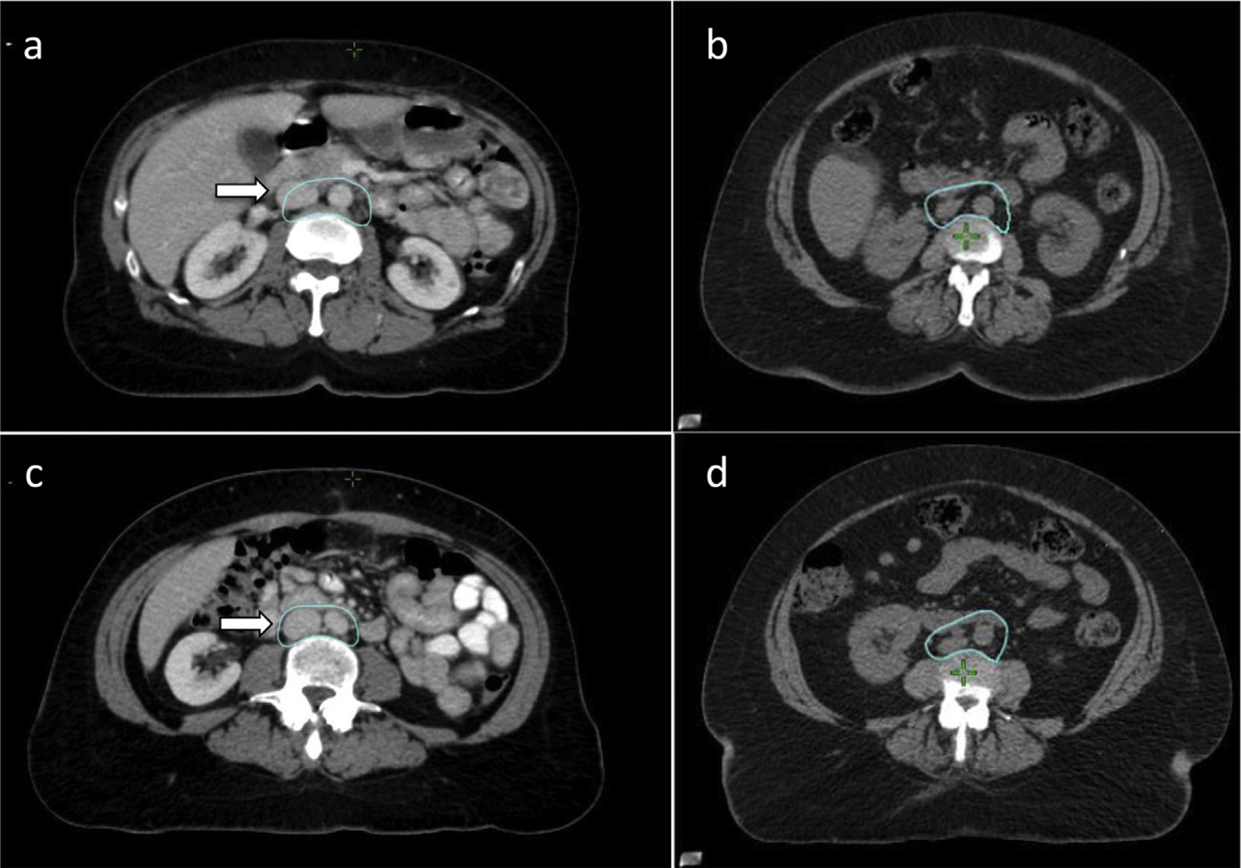 Fig. 3.