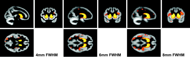 Fig 3.