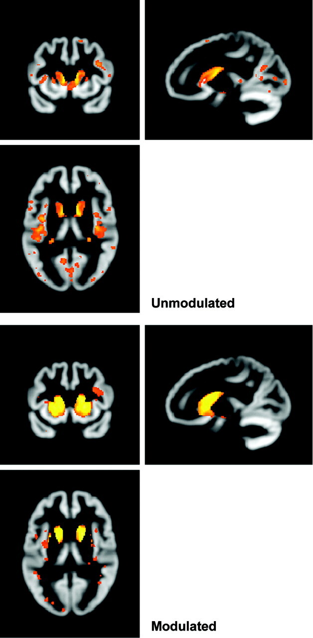 Fig 2.