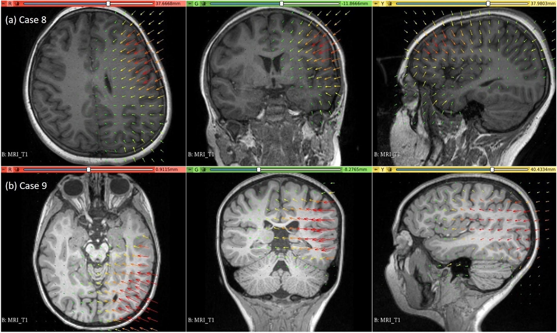 Fig. 11