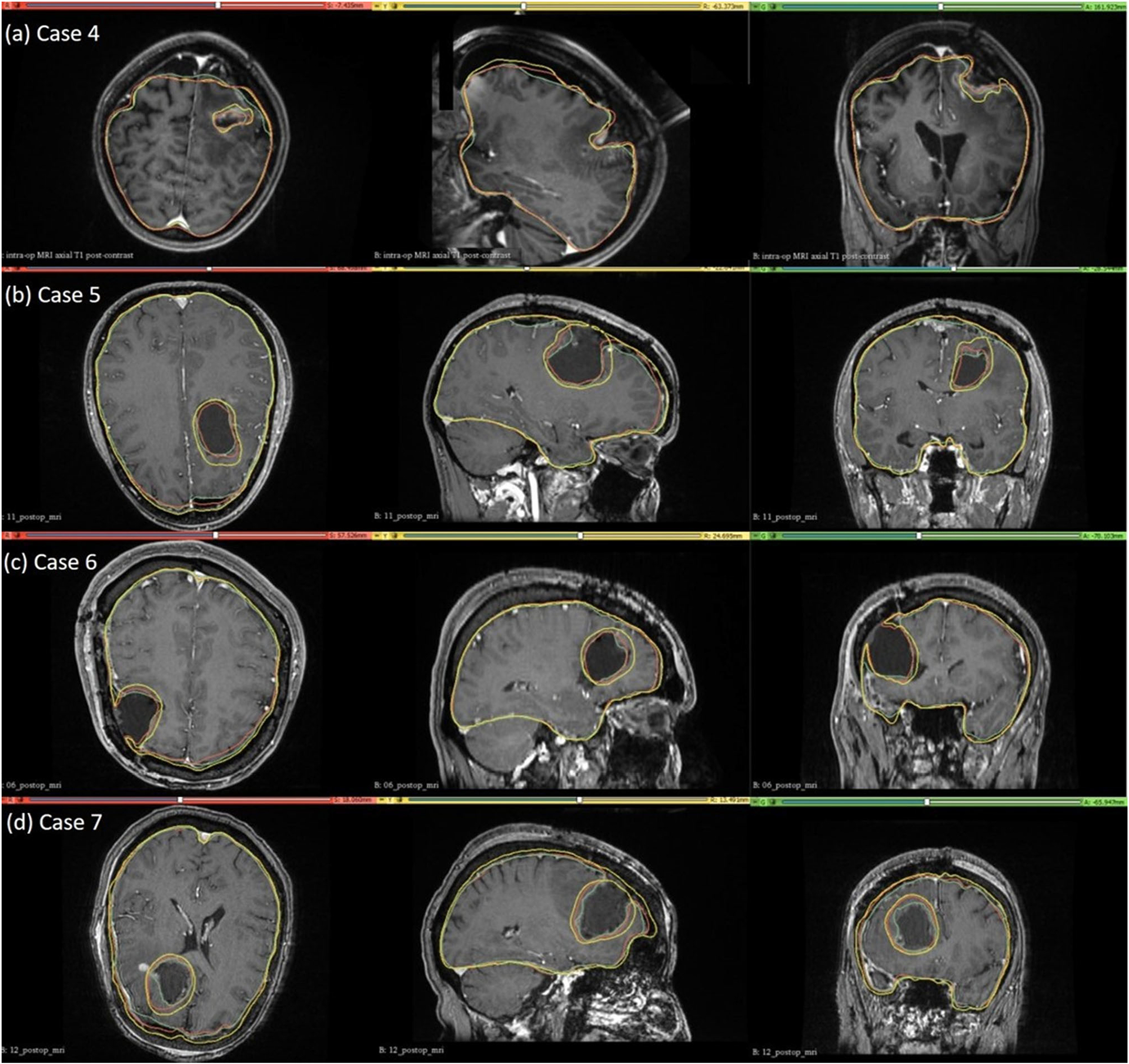 Fig. 9