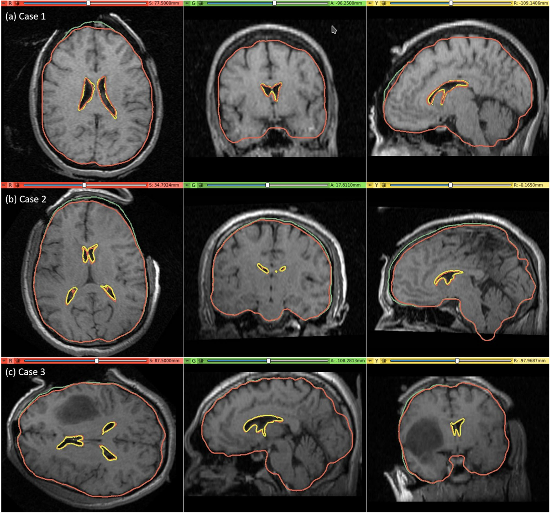 Fig. 7