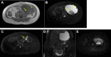 Fig. 2