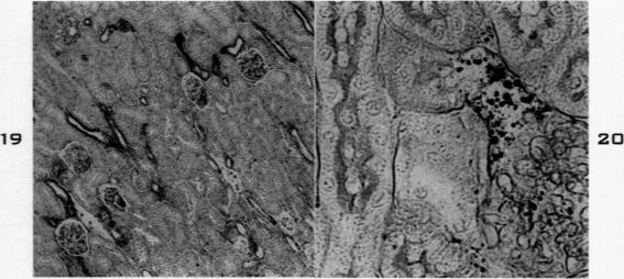 Fig. 19-20