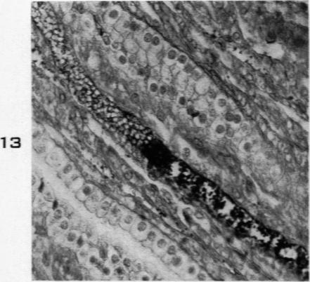 Fig. 13